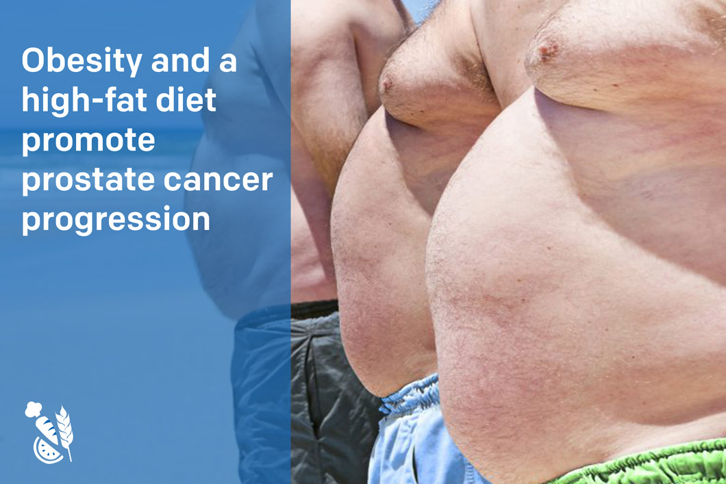 Obesity And A High Fat Diet Promote Prostate Cancer Progression Procure 