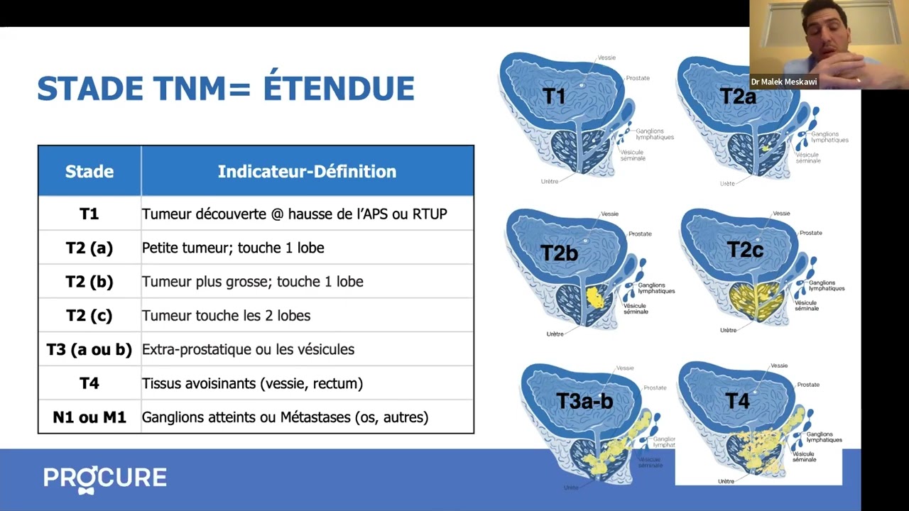 Nouveau diagnostic: Comment choisir un traitement?